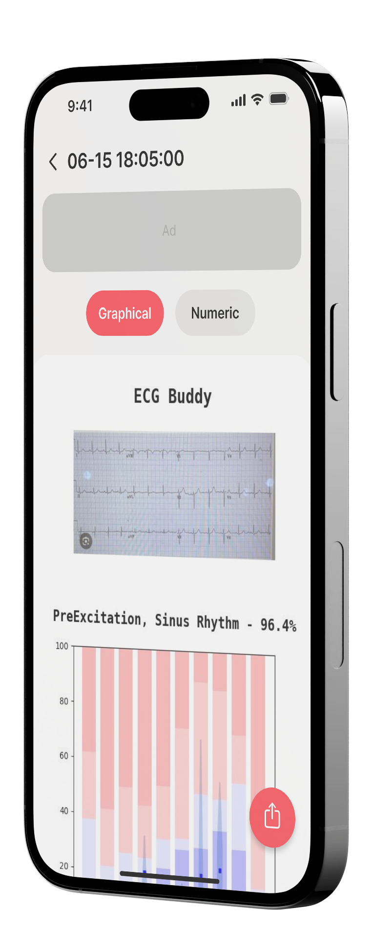 ECG BUDDY