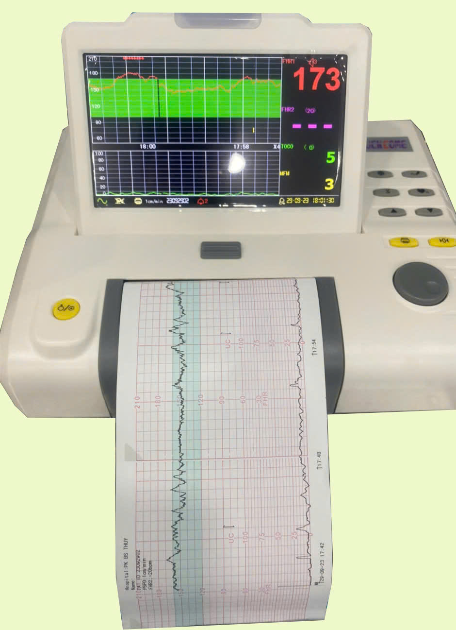 Monitor sản khoa Obstetric monitors