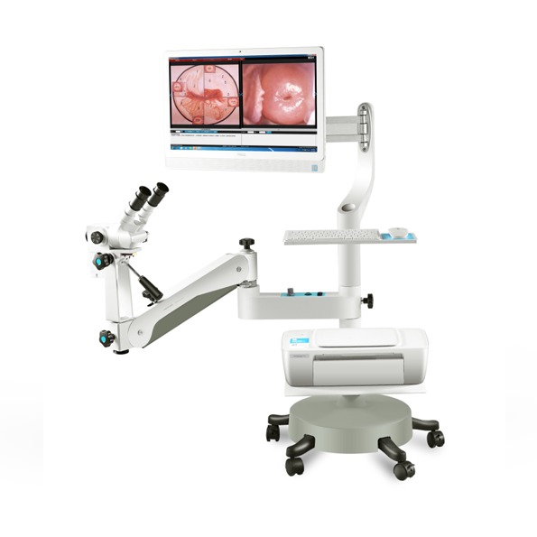 SP1 máy soi cổ tử cung quang hợp, kỹ thuật số