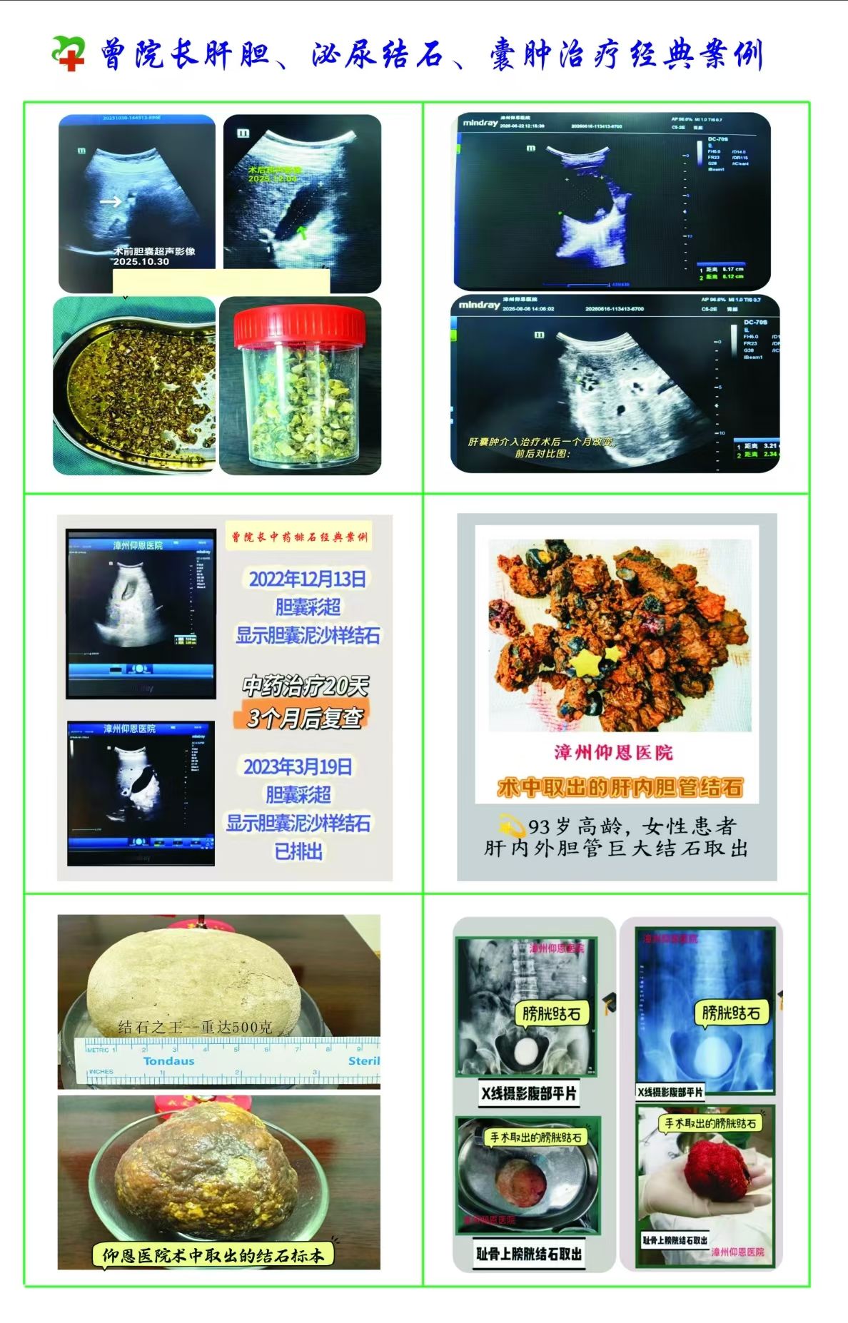 Products