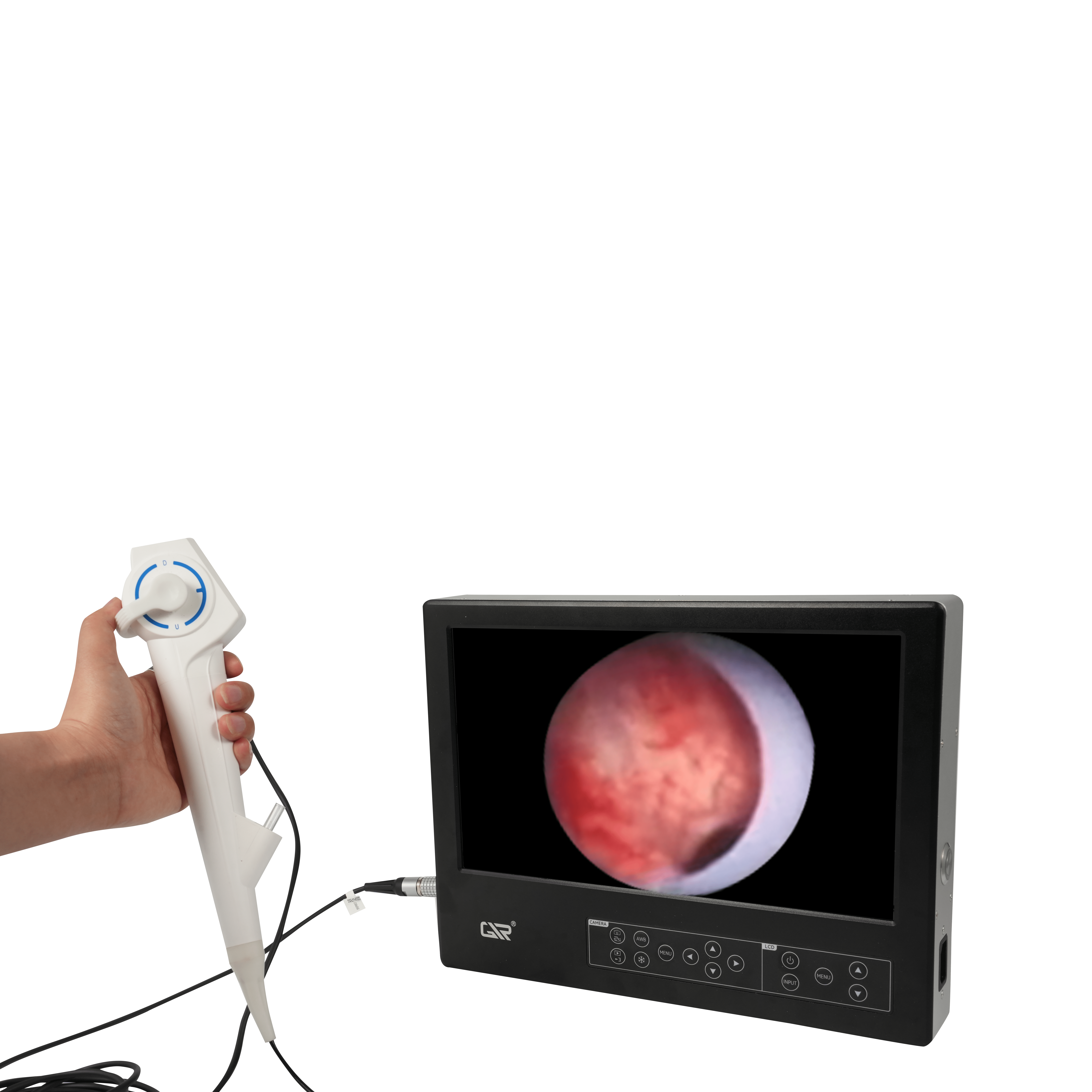 SP2 nội soi điện tử dùng một lần