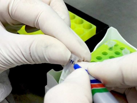 Kit xét nghiệm nCoV của Việt Nam sử dụng thế nào?