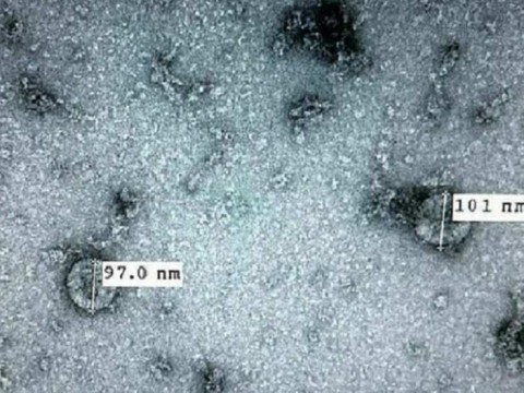 Việt Nam nuôi cấy thành công nCoV